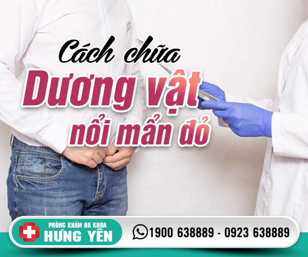 Cách chữa dương vật nổi mẩn đỏ