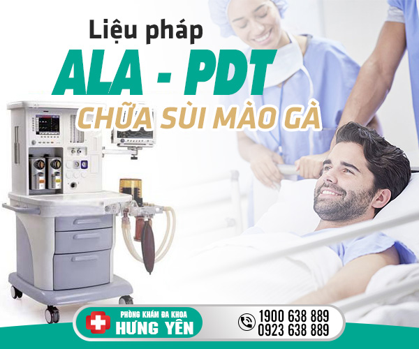 Điều trị sùi mào gà bằng liệu pháp ALA-PDT