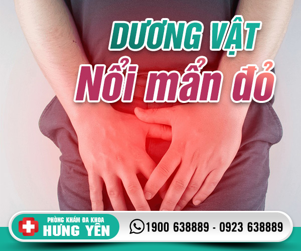 Dương vật nổi mẩn đỏ