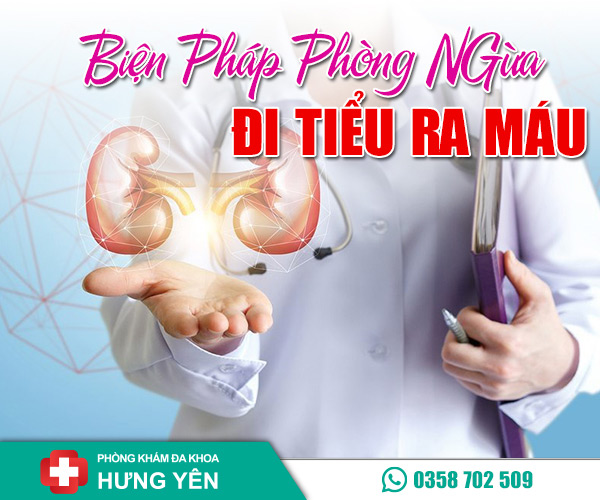 Biện pháp phòng ngừa đi tiểu ra máu