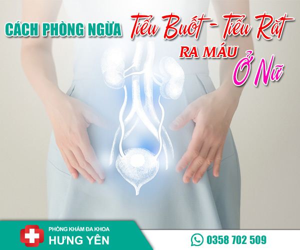 Cách phòng ngừa tiểu buốt tiểu rắt ra máu ở nữ