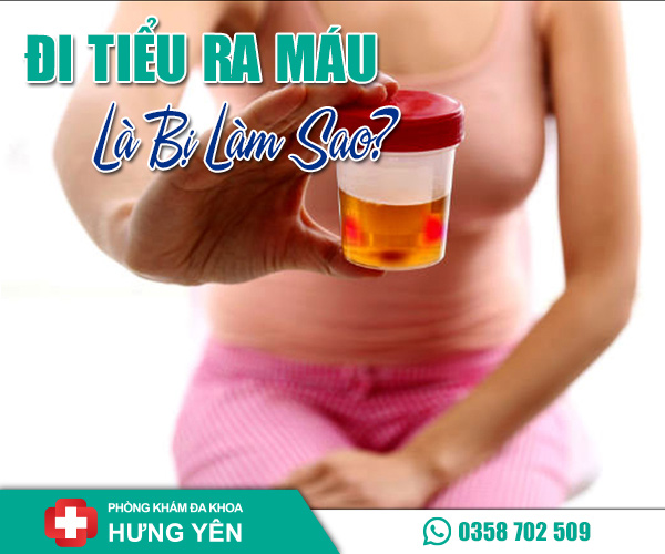 Đi tiểu ra máu bị làm sao