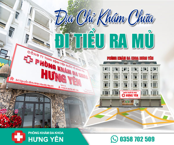 Địa chỉ khám chữa đi tiểu ra mủ