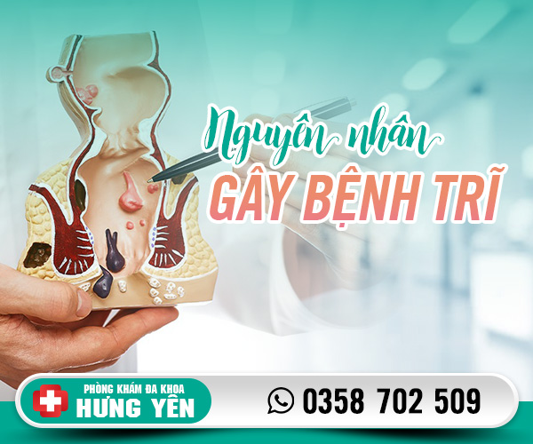 Nguyên nhân gây bệnh trĩ