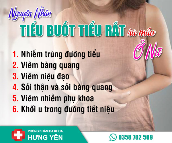 Nguyên nhân tiểu buốt tiểu rắt ra máu ở nữ