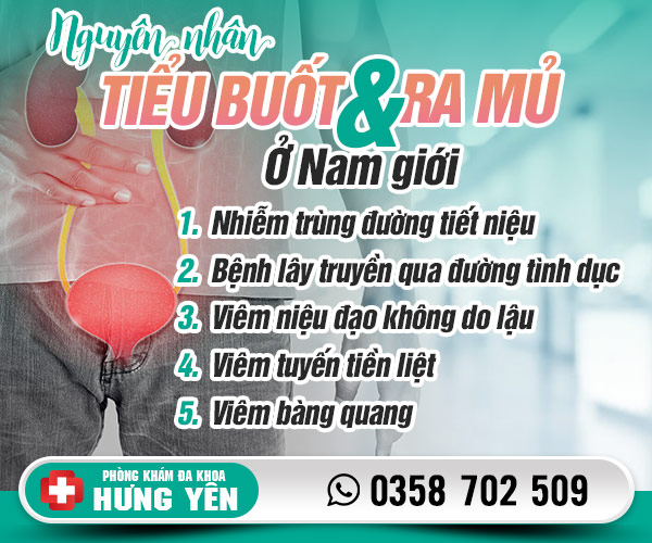 Nguyên nhân đi tiểu buốt và ra mủ ở nam giới