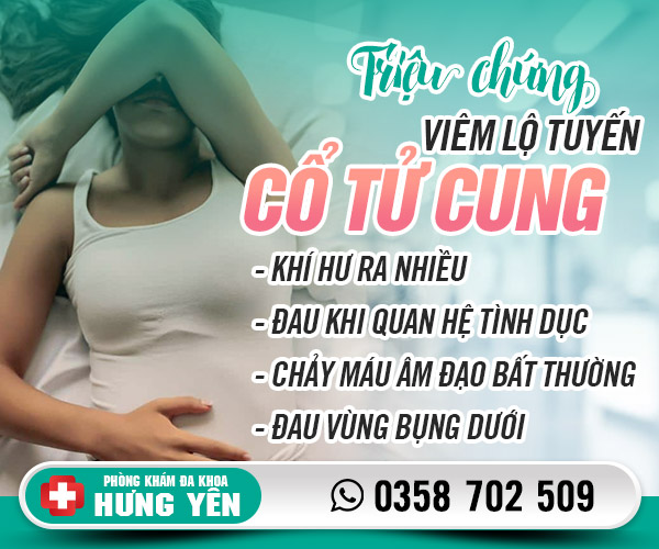 Triệu chứng viêm lộ tuyến cổ tử cung