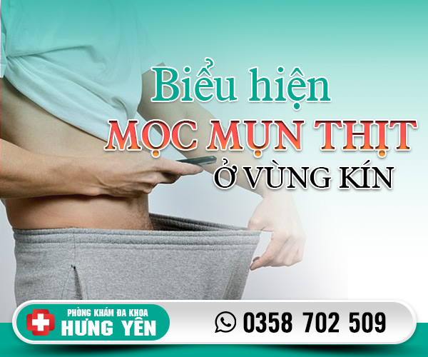 Biểu hiện mọc mụn thịt ở vùng kín