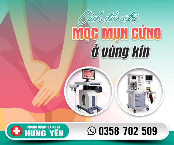 Cách điều trị mọc mụn cứng ở vùng kín