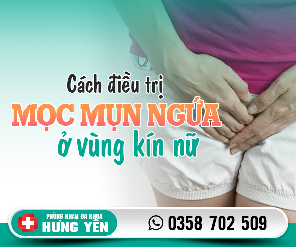 Cách điều trị mọc mụn ngứa ở vùng kín nữ