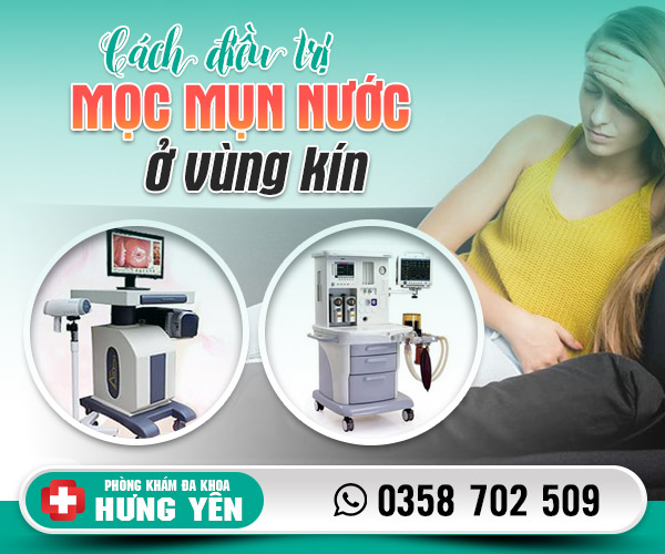 Cách điều trị mọc mụn nước ở vùng kín