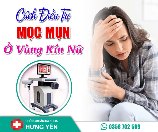 Cách điều trị mọc mụn ở vùng kín nữ