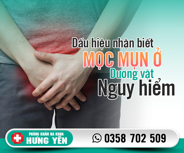 Dấu hiệu nhận biết mọc mụn ở dương vật