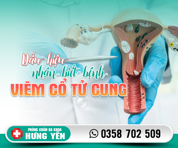 Dấu hiệu nhận biết bệnh viêm cổ tử cung