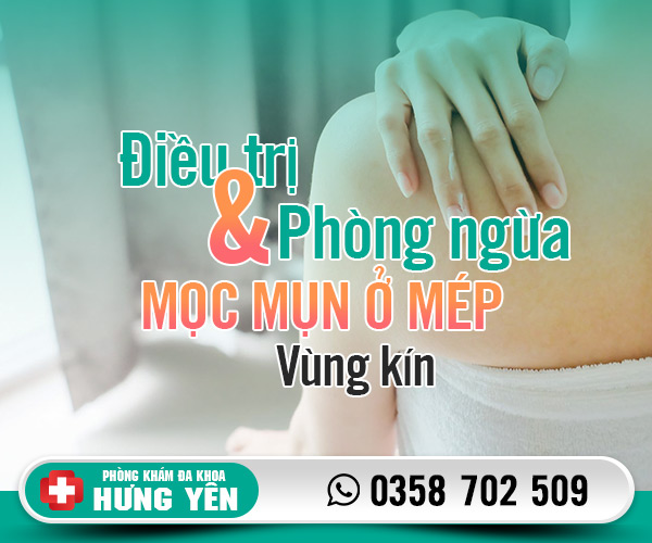 Cách điều trị và phòng ngừa mọc mụn ở mép vùng kín