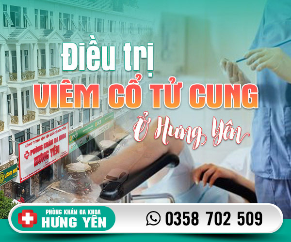 Điều trị viêm cổ tử cung ở Hưng Yên