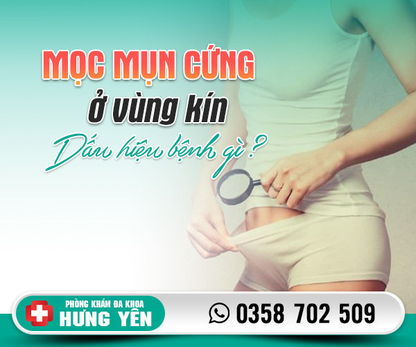 Mọc mụn cứng ở vùng kín dấu hiệu bệnh gì