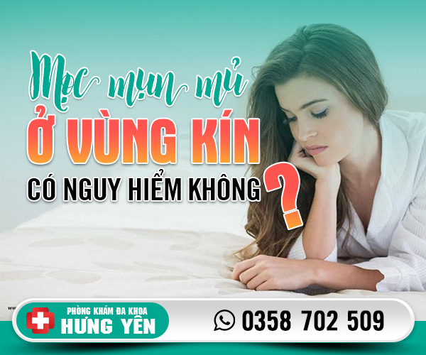 Mọc mụn mủ ở vùng kín có nguy hiểm không?