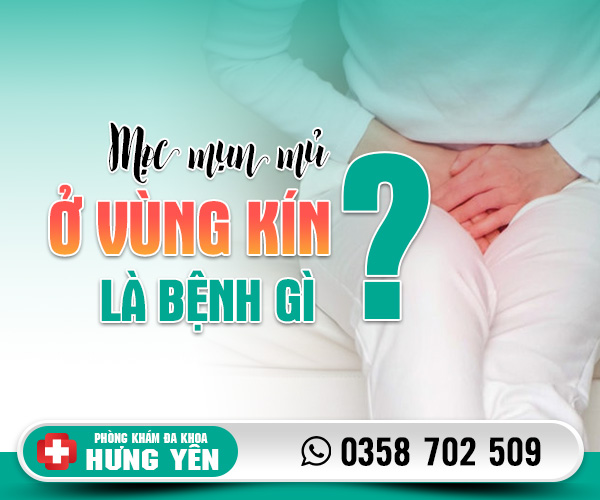 Mọc mụn mủ ở vùng kín