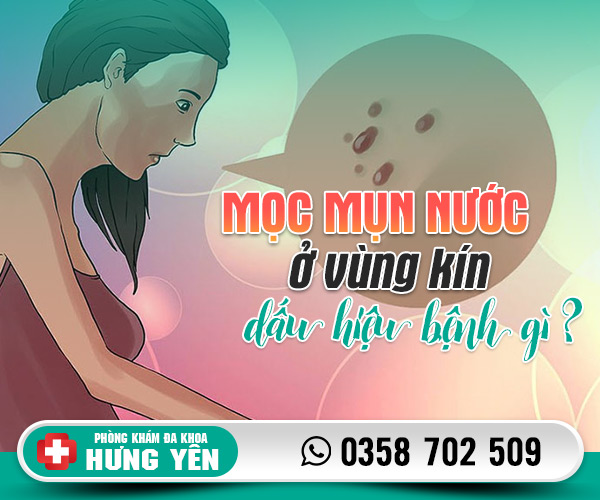 Mọc mụn nước ở vùng kín dấu hiệu bệnh gì