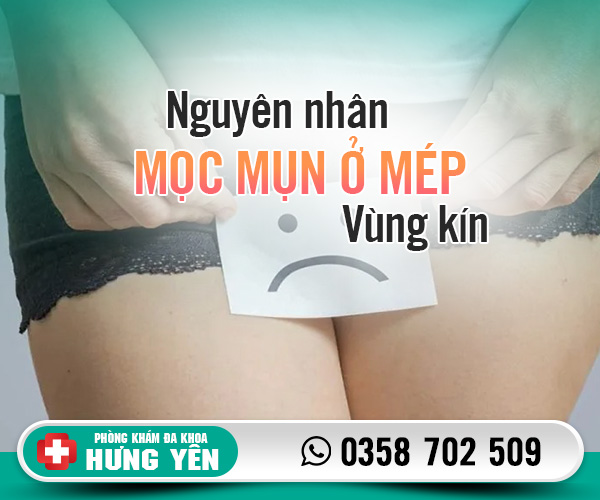 Nguyên nhân mọc mụn ở mép vùng kín