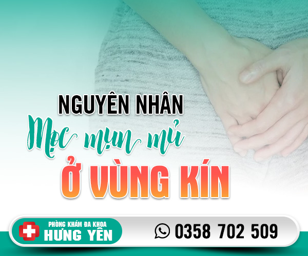 Nguyên nhân mọc mụn mủ ở vùng kín