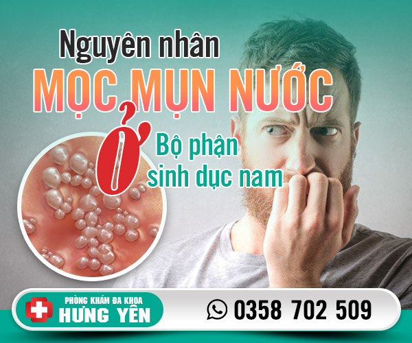 Nguyên nhân mọc mụn nước ở bộ phận sinh dục