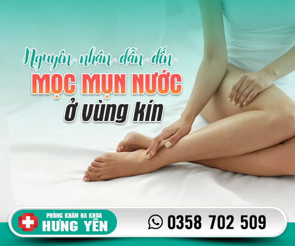 Nguyên nhân mọc mụn nước ở vùng kín