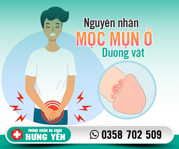 Nguyên nhân mọc mụn ở dương vật