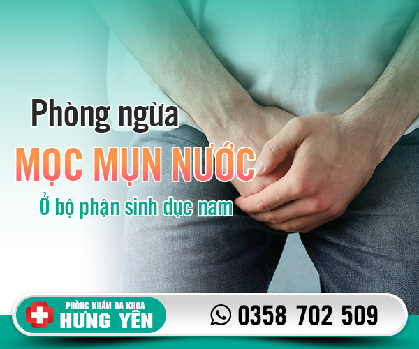 Phòng ngừa mọc mụn nước ở bộ phận sinh dục nam