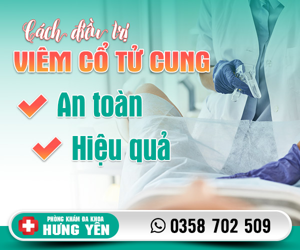 Cách điều trị viêm cổ tử cung