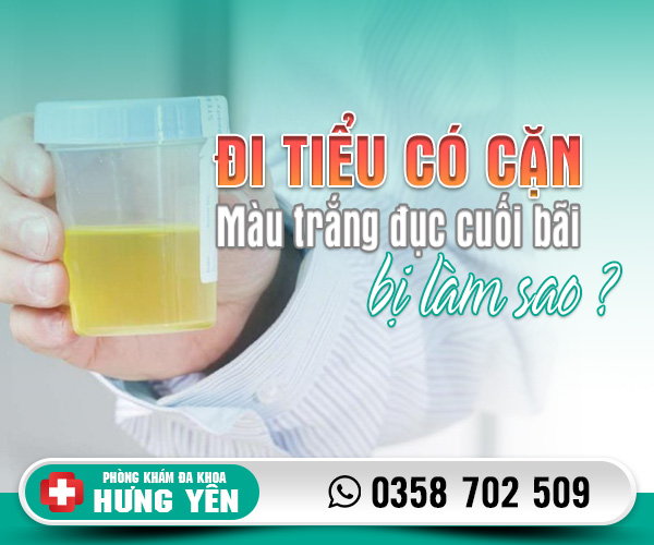 Đi tiểu có cặn màu trắng đục cuối bãi bị làm sao