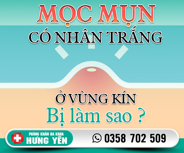 Mọc mụn có nhân trắng ở vùng kín bị làm sao