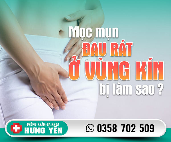 Mọc mụn đau rát ở vùng kín bị làm sao