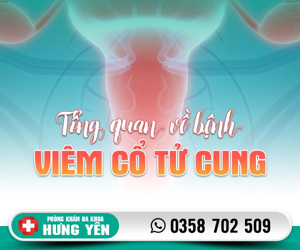 Tổng quan về bệnh viêm cổ tử cung