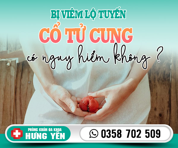 Bị viêm lộ tuyến cổ tử cung có nguy hiểm không