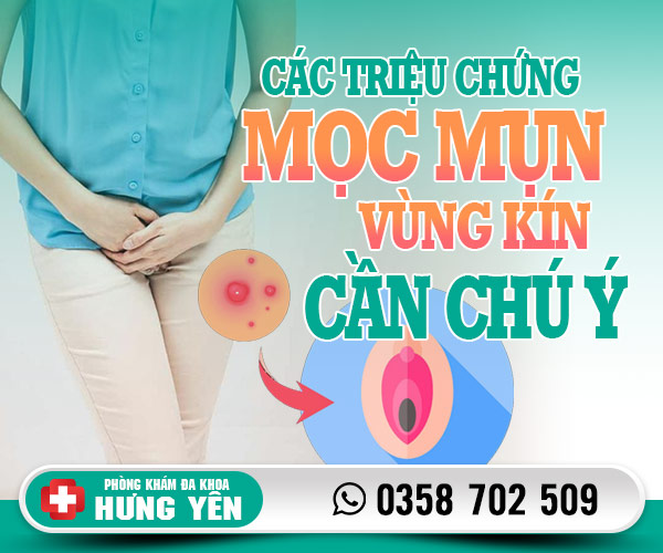 Các triệu chứng mọc mụn ở vùng kín nữ cần chú ý