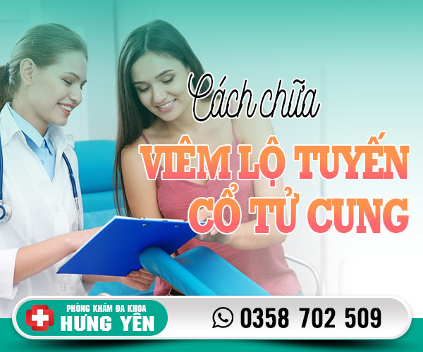 Cách chữa viêm lộ tuyến cổ tử cung