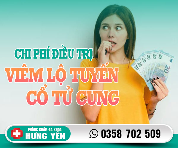 Chi phí điều trị viêm lộ tuyến cổ tử cung