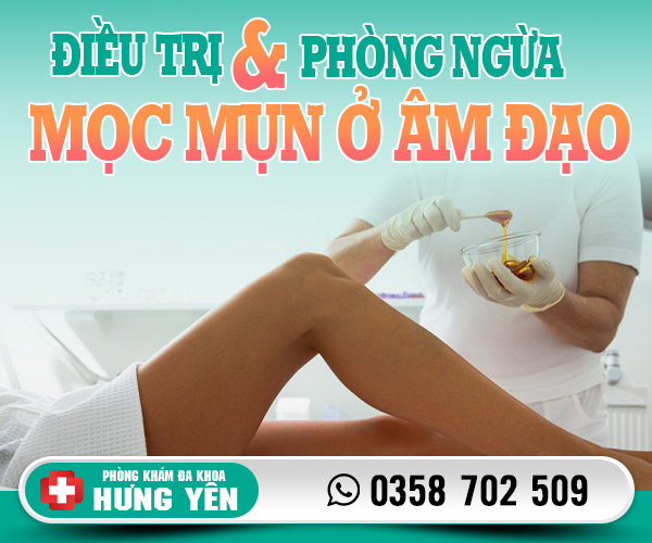 Cách điều trị và phòng ngừa mọc mụn ở âm đạo