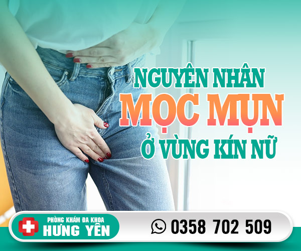 Nguyên nhân mọc mụn ở vùng kín nữ