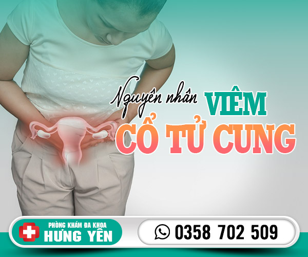 Nguyên nhân viêm cổ tử cung