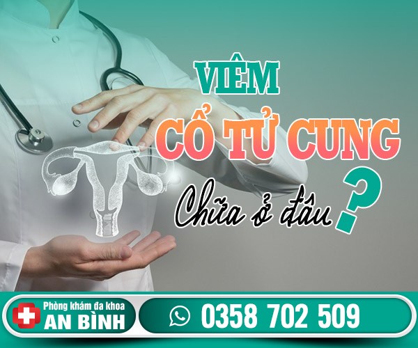 Viêm cổ tử cung chữa ở đâu tốt