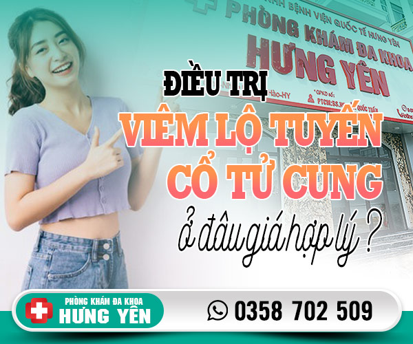 Điều trị viêm lộ tuyến cổ tử cung ở đâu