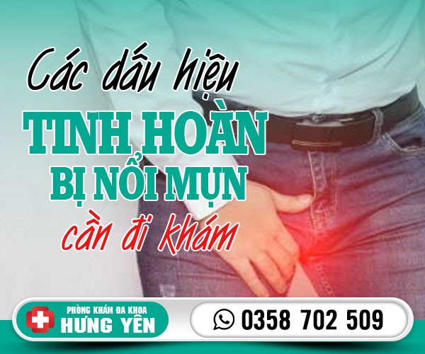 Các dấu hiệu tinh hoàn bị nổi mụn