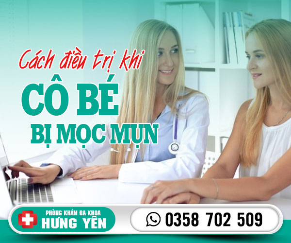 Cách điều trị khi cô bé bị mọc mụn