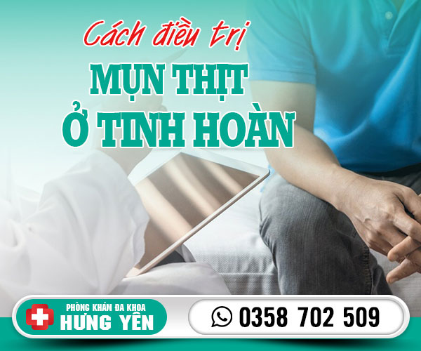 Cách điều trị mụn thịt ở tinh hoàn