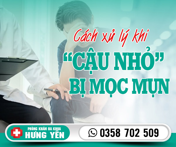 Cách xử lý khi cậu nhỏ bị mọc mụn