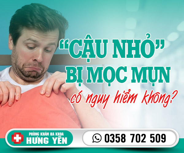 Cậu nhỏ bị mọc mụn có nguy hiểm không