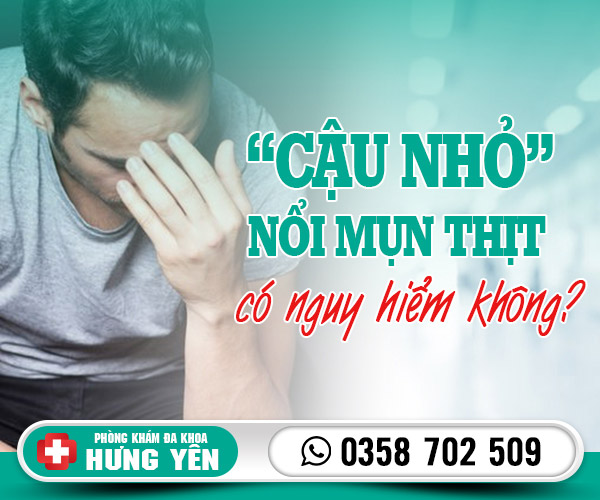 Cậu nhỏ nổi mụn thịt có nguy hiểm không